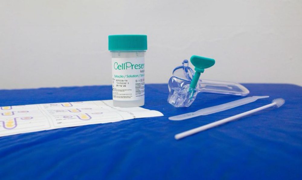 SUS detecta quase 10 mil testes positivos para HPV de alto risco Imagem referente a SUS detecta quase 10 mil testes positivos para HPV de alto risco