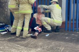 Homem é violentamente agredido com enxada no Conjunto Abelha Homem é violentamente agredido com enxada no Conjunto Abelha